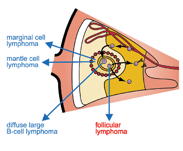 An image showing where follicular lymphoma is located
