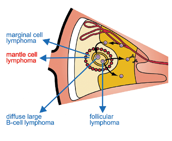 An image showing where mantle cell lymphoma is located