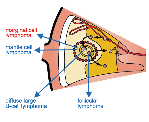 An image showing where marginal cell lymphoma is located
