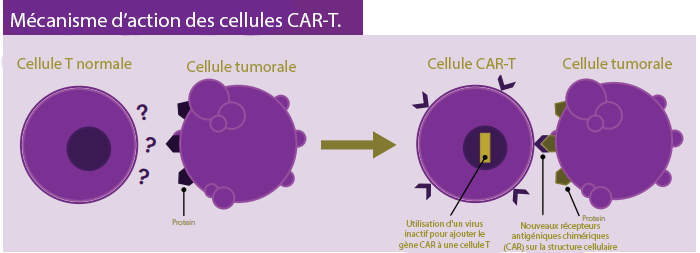 La thérapie CAR T-cell